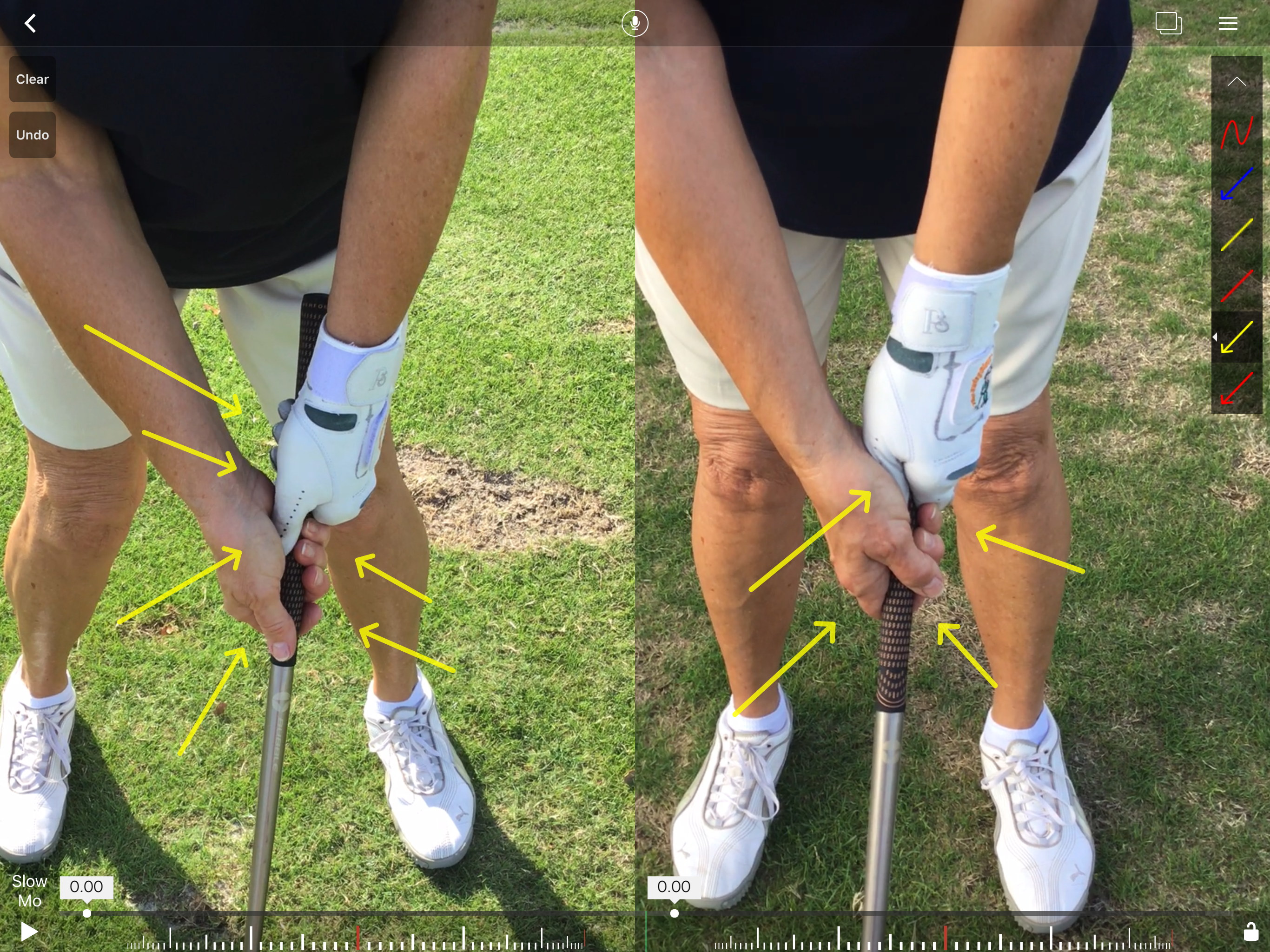 Proper Grip Technique – Before & After